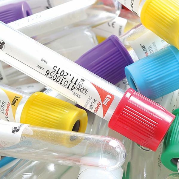 sistemas de extraccion al vacio 2 biogen